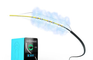 Adding 8–12mm diameter devices to the Shockwave Peripheral Intravascular Lithotripsy toolkit