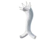 Five-year results of the LEOPARD trial published in the Journal of Vascular Surgery LEOPARD