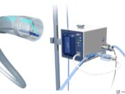 JETi registry provides “remarkable results” for peripheral thrombectomy system Jeti peripheral thrombectomy