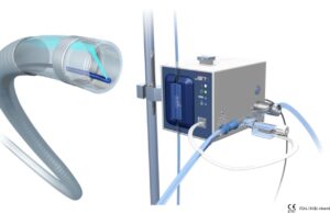 JETi registry provides “remarkable results” for peripheral thrombectomy system Jeti peripheral thrombectomy