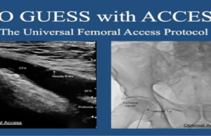 VQI@VAM: Social media helps promote safe technique, study finds