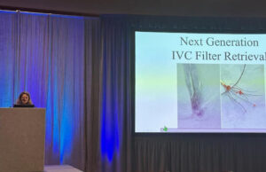 NESVS 2023: Novel IVC filter retrieval device slashes procedural time and radiation exposure during in vivo experiments, Yale researchers report