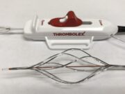 Thrombolex announces new insights from the RESCUE trial with the Bashir endovascular catheter