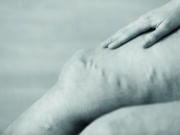 SVS varicose vein guideline webinar set for Oct. 10