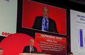 Researchers report 30-day outcome data for pair of investigational carotid stenting systems