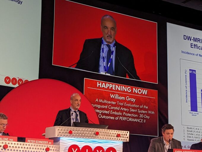 Researchers report 30-day outcome data for pair of investigational carotid stenting systems