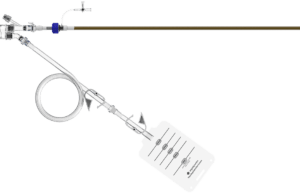 Enrollment complete in APEX-AV study of mechanical aspiration system for acute PE