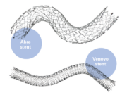 Nitinol stents placed in iliac veins “not associated with prolonged back pain,” study finds