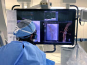 FORS-powered LumiGuide 3D imaging technology is rolled out at specialized centers in U.S. and Europe