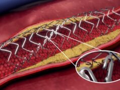 FDA Breakthrough Device designation granted for DynamX BTK for use in CLTI treatment below the knee