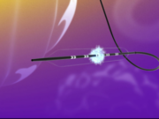 FastWave Medical announces successful 30-day first-in-human data on peripheral IVL technology