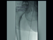 Radiation safety session seeks to address variability and improve access to education