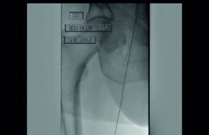 Radiation safety session seeks to address variability and improve access to education