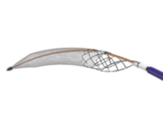 Inari Medical updates ClotTriever XL IFU amid FDA recall notice