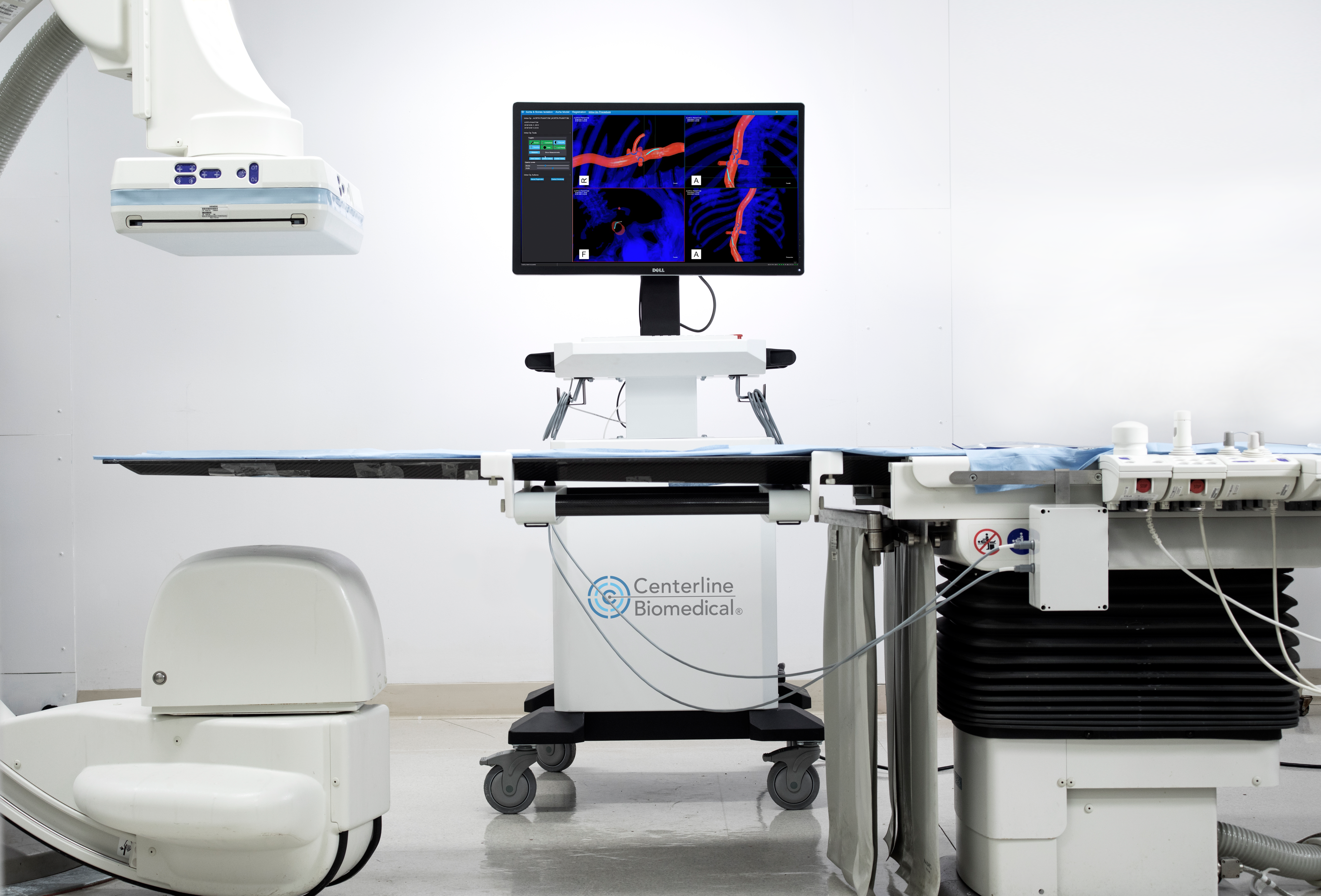 Centerline Biomedical receives FDA 510(k) clearance for new IOPS Viewpoint catheter