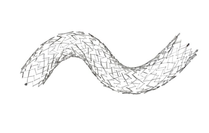 ABRE subanalysis highlights obesity ‘paradox’ in post-venous stenting outcomes Abre
