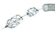 Pounce Thrombectomy Platform use in acute limb ischemia: Vascular surgeons weigh in