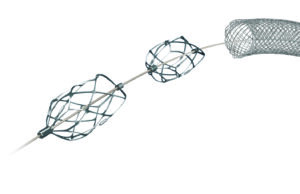 Pounce Thrombectomy Platform use in acute limb ischemia: Vascular surgeons weigh in