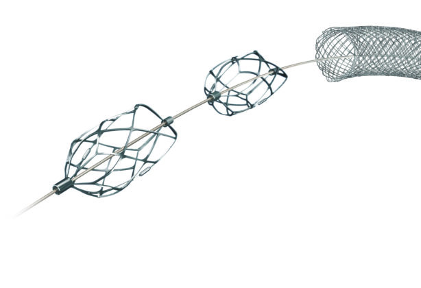 Acute limb ischemia: Vascular surgeons weigh in