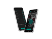 Novel AI-assisted DVT diagnostic pathway aims to ‘democratize’ point-of-care ultrasound