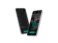 Novel AI-assisted DVT diagnostic pathway aims to ‘democratize’ point-of-care ultrasound