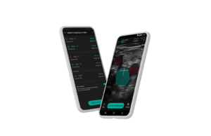 Novel AI-assisted DVT diagnostic pathway aims to ‘democratize’ point-of-care ultrasound