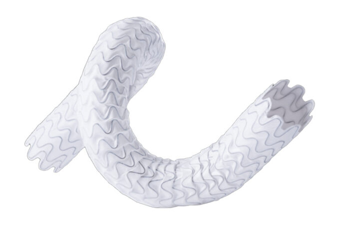 WAVE trial AVG cohort also benefits at six months with Wrapsody Wrapsody device