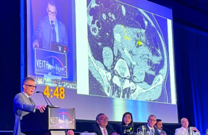 In search of the ‘holy grail’: New analysis brings aneurysm rupture prediction closer