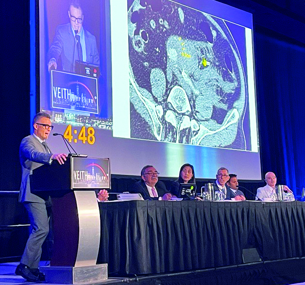 In search of the ‘holy grail’: New analysis brings aneurysm rupture prediction closer