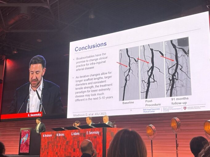 Data and device tweaks herald ‘practice-changing’ future for bioabsorbable scaffolds