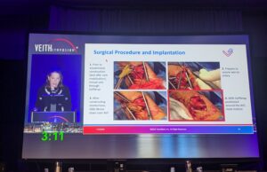 Novel bioabsorbable perivascular wrap aims to reduce AVF failure