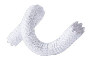 One-year WAVE trial results show patency advantage for Wrapsody versus PTA