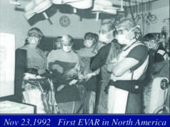 Founding fathers of EVAR set to gather to mark 40 years of aortic stent graft development