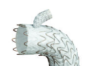 Gore Tag thoracic branch endoprosthesis receives expanded FDA approval for endovascular aortic arch repair