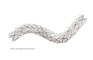 Gore announces MDR expanded indication for the Viabahn VBX balloon-expandable endoprosthesis as a bridging stent VBX stent graft