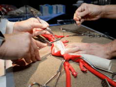 Explore the future of vascular surgery at Touchpoint@VAM