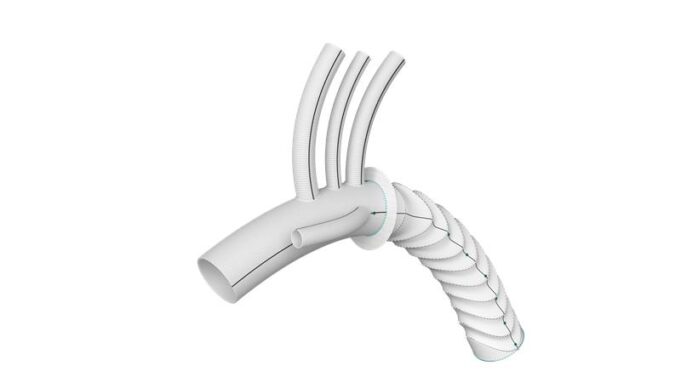 Terumo Aortic announces ‘significant policy milestone’ with CMS establishing new DRG 209 for complex aortic arch procedures