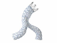 Medtronic’s Endurant receives FDA labelling approval to remove rAAA treatment warning