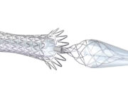 Medtronic fully launches Neuroguard IEP system