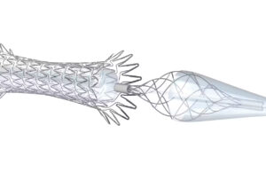 Medtronic fully launches Neuroguard IEP system