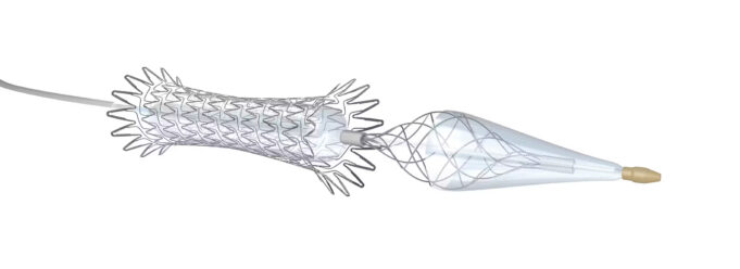 Medtronic fully launches Neuroguard IEP system