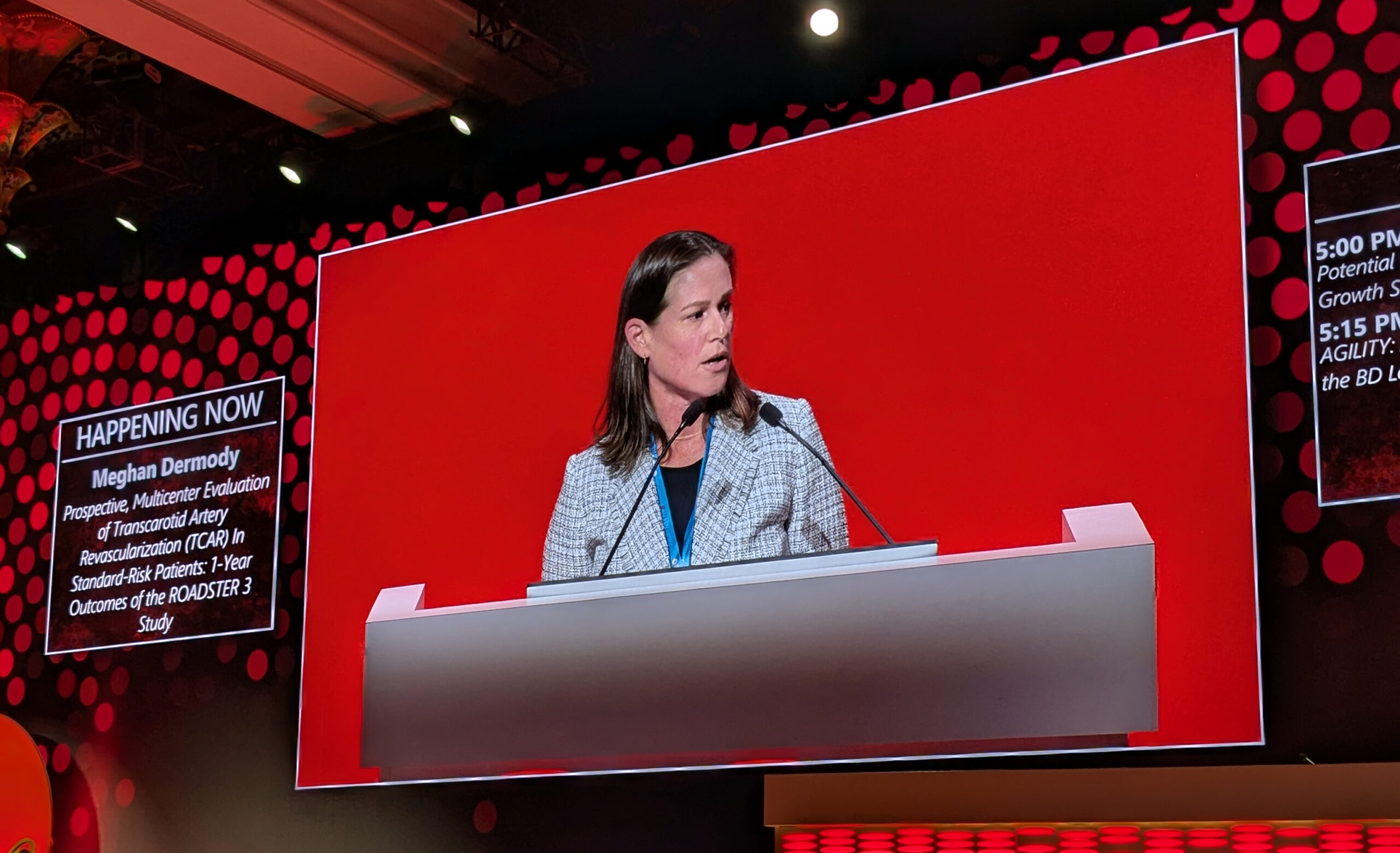 ‘Excellent’ one-year outcomes from ROADSTER 3 show TCAR is ‘safe and effective’