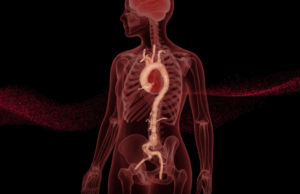 RapidAI earns US FDA clearance for AI-driven aortic measurement and surveillance product