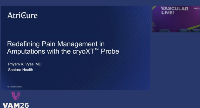 Redefining pain management in amputations with cryoXT