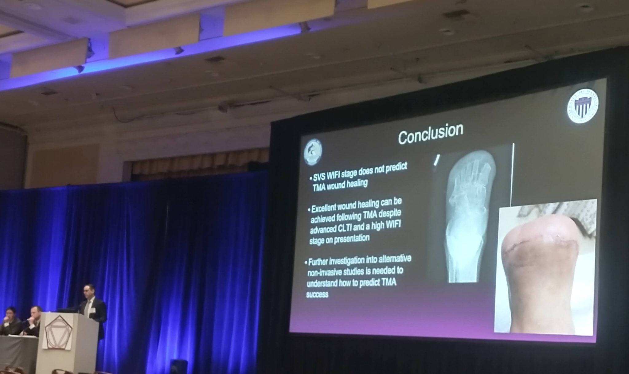 SCVS 2022: WIfI score does not predict successful healing after transmetatarsal amputation, study finds