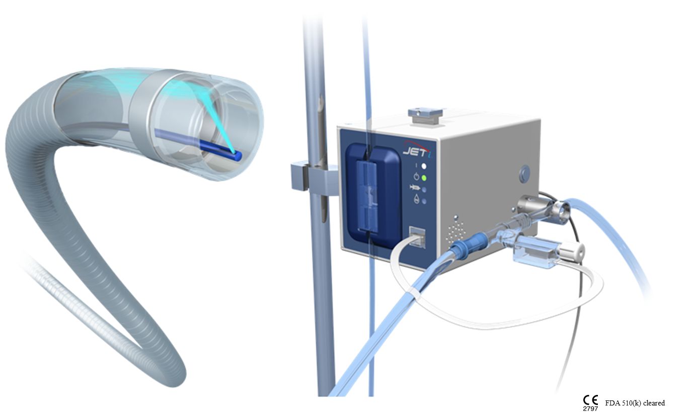 JETi registry provides “remarkable results” for peripheral thrombectomy system