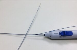 Intravenous anesthesia delivery during varicose vein treatment proves safe and reduces pain scores, researcher reports