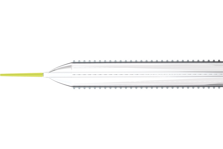 Serration angioplasty associated with reduced recoil in infrapopliteal arteries compared with plain balloon angioplasty